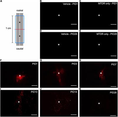 Mitochondrial Transplantation Attenuates Neural Damage and Improves Locomotor Function After Traumatic Spinal Cord Injury in Rats